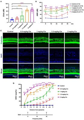 Role and mechanism of FOXG1-related epigenetic modifications in cisplatin-induced hair cell damage